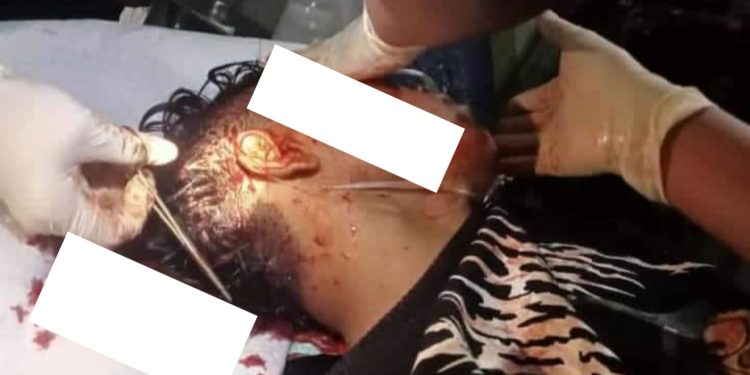 Antar Ayah Berbelanja Plastik Pemuda Bujur Tengah Tewas Dibacok